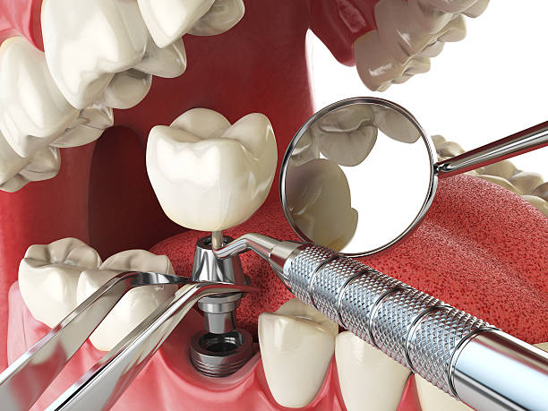 Best Weekend Emergency Dentist in El Dorado Springs, MO