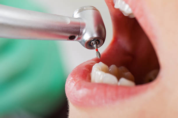 Best Emergency Dental Extractions in El Dorado Springs, MO
